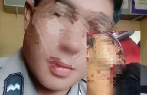 Tindak Tegasss… Oknum Anggota Polres Melawi Dilaporkan Ke Propam, Diduga Aniaya Warga Pakai Senjata Tajam
